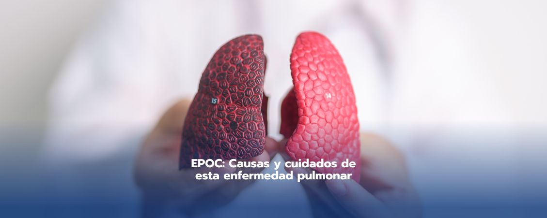 EPOC: Preguntas frecuentes sobre esta enfermedad pulmona