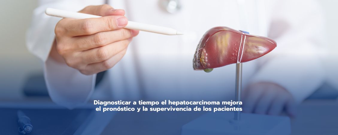 Cáncer de hígado: Hepatocarcinoma y sus causas